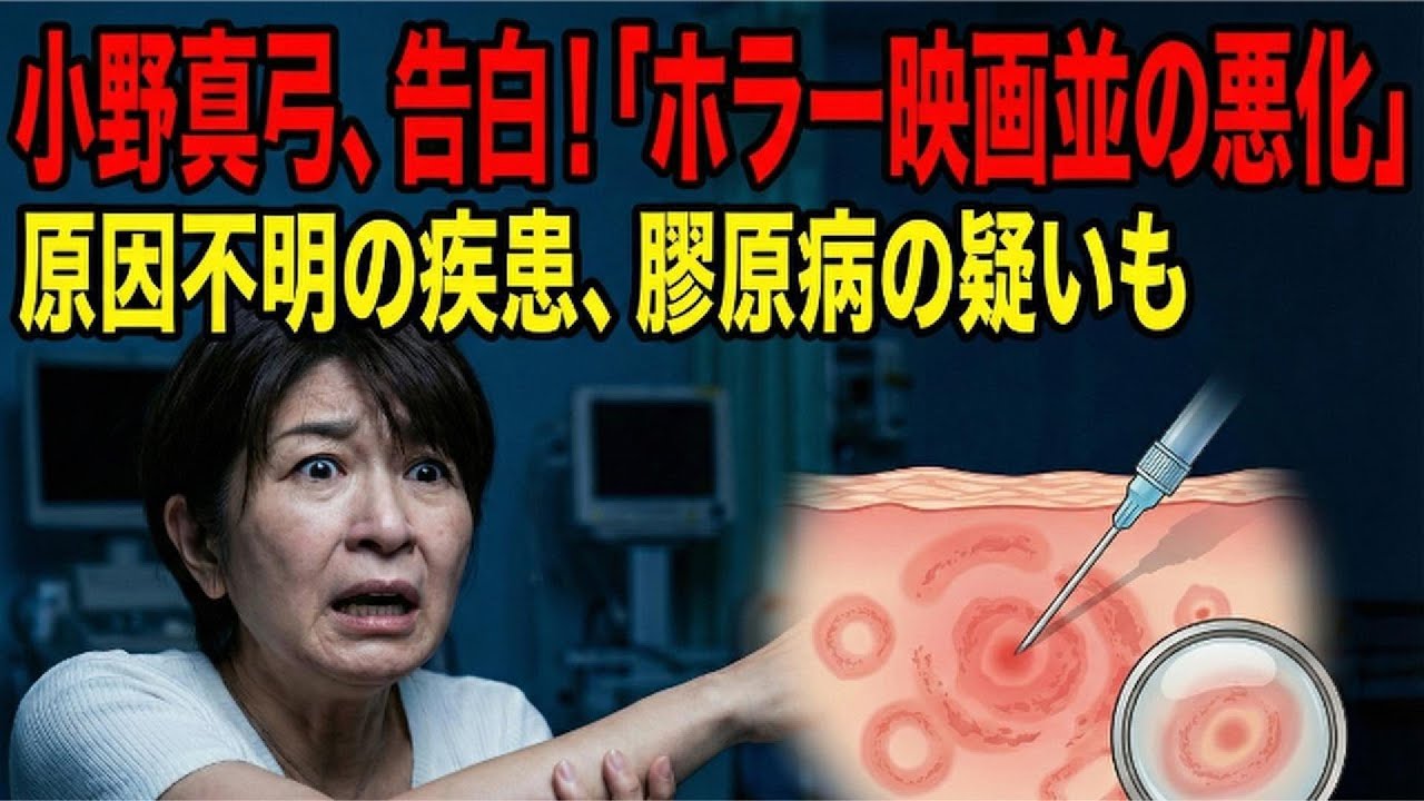 小野真弓、原因不明の疾患を明かす「ホラー映画並の悪化」膠原病の疑いも