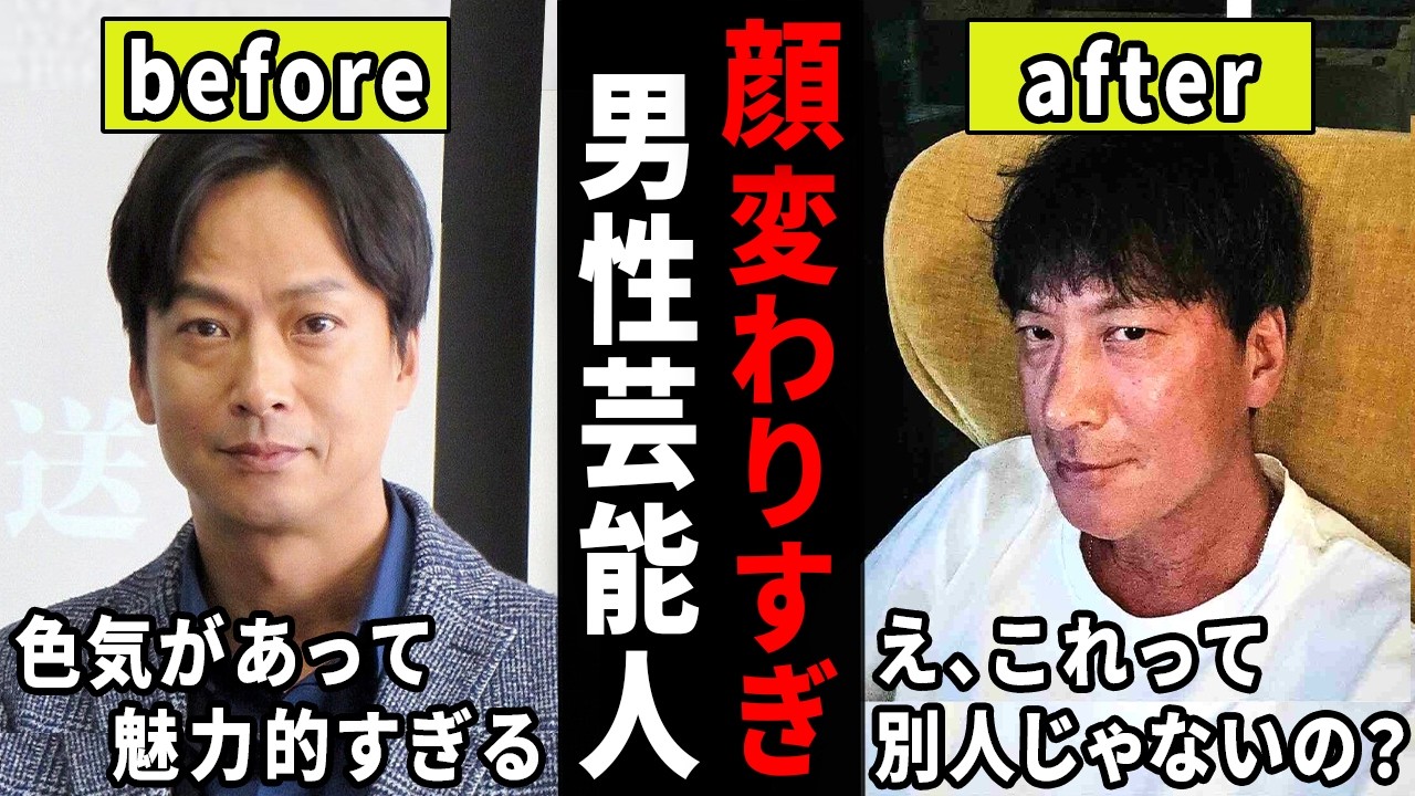 え、もしかして整形した…?昔と顔が変わりすぎな男性芸能人【ガルちゃん芸能・有益2ch】